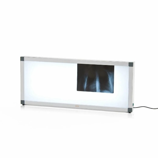 Негатоскоп 